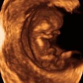 Foetus at 12 weeks,3-D ultrasound scan