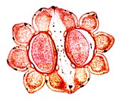Fool's parsley fruit,light micrograph