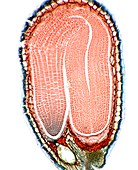 Shepherd's purse seed,light micrograph