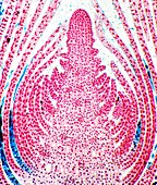 Huckleberry shoot,light micrograph
