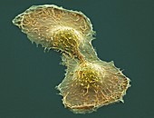 HeLa cell division,SEM