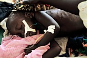 Child patient,Uganda
