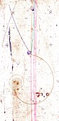 Pion-proton collision