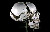 19th century Beauchene 'exploded' skull