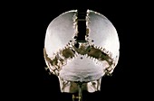 19th century Beauchene 'exploded' skull