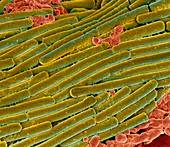 Clostridium difficile bacteria,SEM