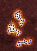 Norovirus particles,TEM