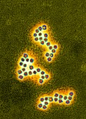 Norovirus particles,TEM