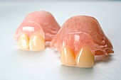 Plastic dentures
