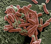 Bacterial contamination,SEM