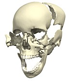 Disarticulated skull