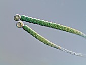 Gloeotrichia cyanobacteria