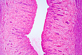 Cross-section of human vagina. LM