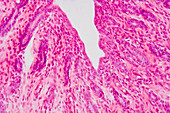 Cross-section of the human vagina. LM