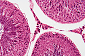 Three seminiferous tubules in testis