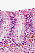 Simple columnar epithelium,appendix