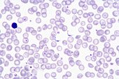 Trypanosoma cruzi cause Chagas disease