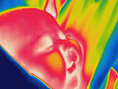 Thermogram of infant being held closely