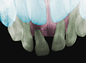 X-ray showing baby and sdult teeth