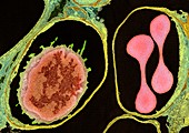 Lung alveoli and blood cells,TEM