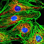 Pulmonary artery cells