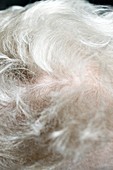 Elderly woman's hair