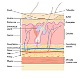 Skin disorders,artwork