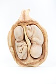 Twin foetus model