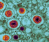 Herpes virus,TEM