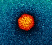 Adenovirus particle,TEM