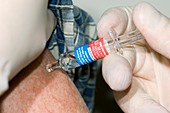 Seasonal flu vaccination