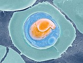 Malarial blood cell,SEM