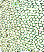 Liverwort leaf tissue,light micrograph