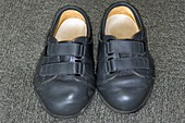 Surgical shoes for arthritic patient