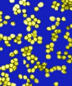 Yellow Fever Virus