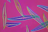 Pleurosigma sp diatoms,light micrograph