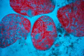 Stentor ciliate protozoa light micrograph