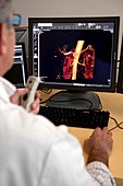 Radiologist assessing a scan