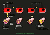 Familial hypercholesterolaemia,diagram