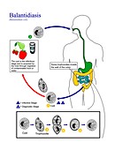 Balantidiasis parasite life cycle