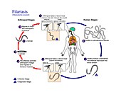 Serous cavity filariasis life cycle