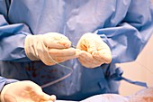 Coronary angioplasty surgery