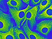 Keratinocyte skin cells,light micrograph
