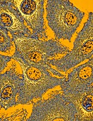 Keratinocyte skin cells,light micrograph