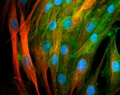Adipose stem cells,light micrograph
