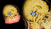 Language and brain activity,MRI scan