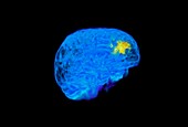 Child's brain activity,MRI scan