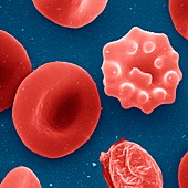 Malaria infected red blood cell,SEM