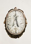 Brain ventricles,1844 artwork