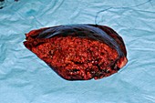 Excised liver